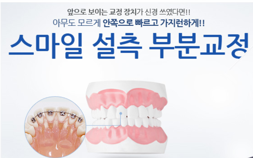 신논현역치과 부분교정잘 하는 치과 관련 이미지 4