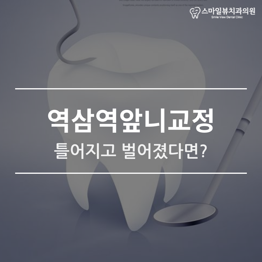 역삼역앞니교정 틀어지고 벌어졌다면? 관련 이미지 1