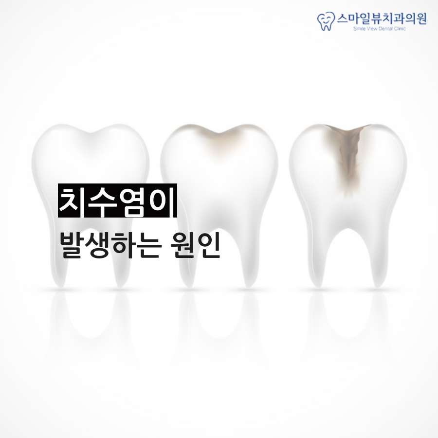 역삼치과치아진료 치수염의 위험성 관련 이미지 2