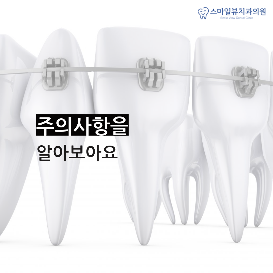 역삼치과심한돌출입 치아교정으로 증상 완화 관련 이미지 4