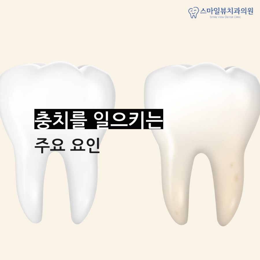 역삼동치아크라운 신경으로 가기 전에 관련 이미지 2