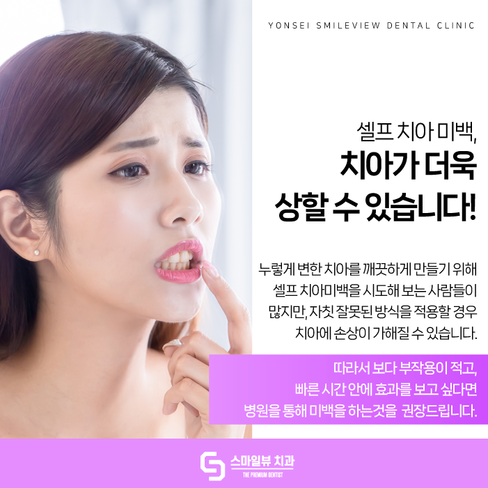 강남치아미백 누런 치아 개선해 보세요. 관련 이미지 2