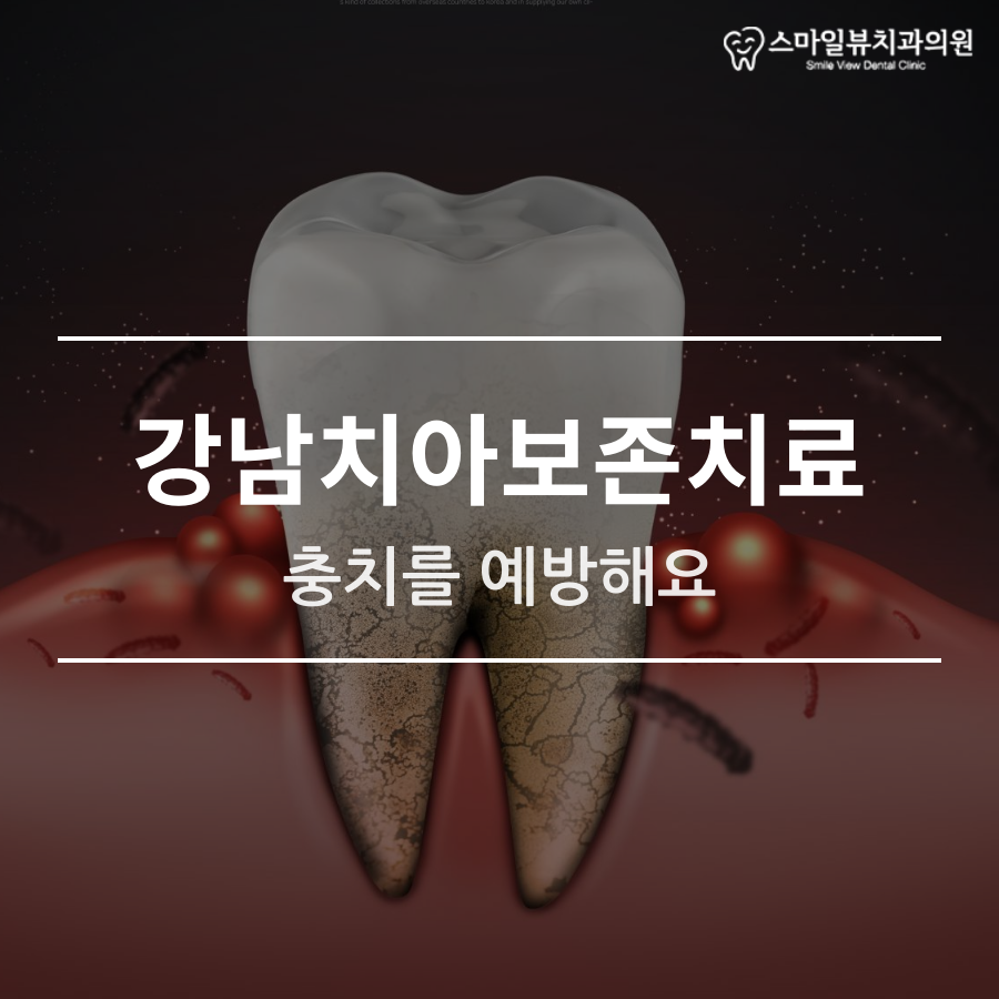 강남치아보존치료 충치를 예방해요 관련 이미지 1