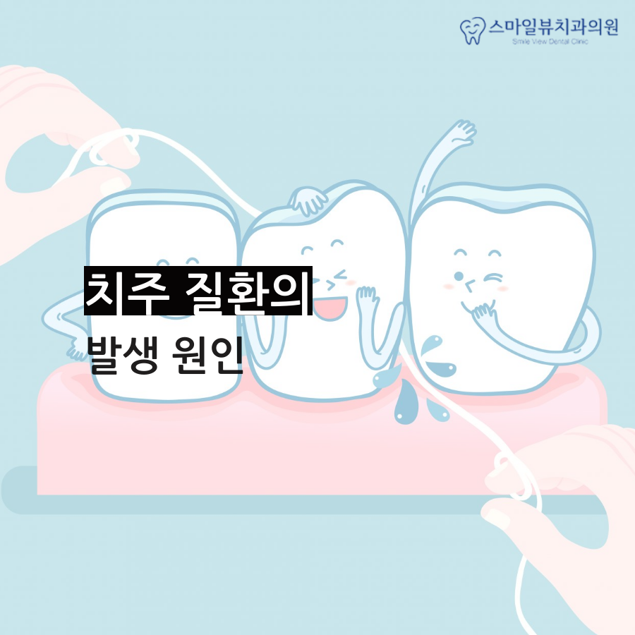 역삼치과스케일링 충치와 잇몸질환 예방법 관련 이미지 2