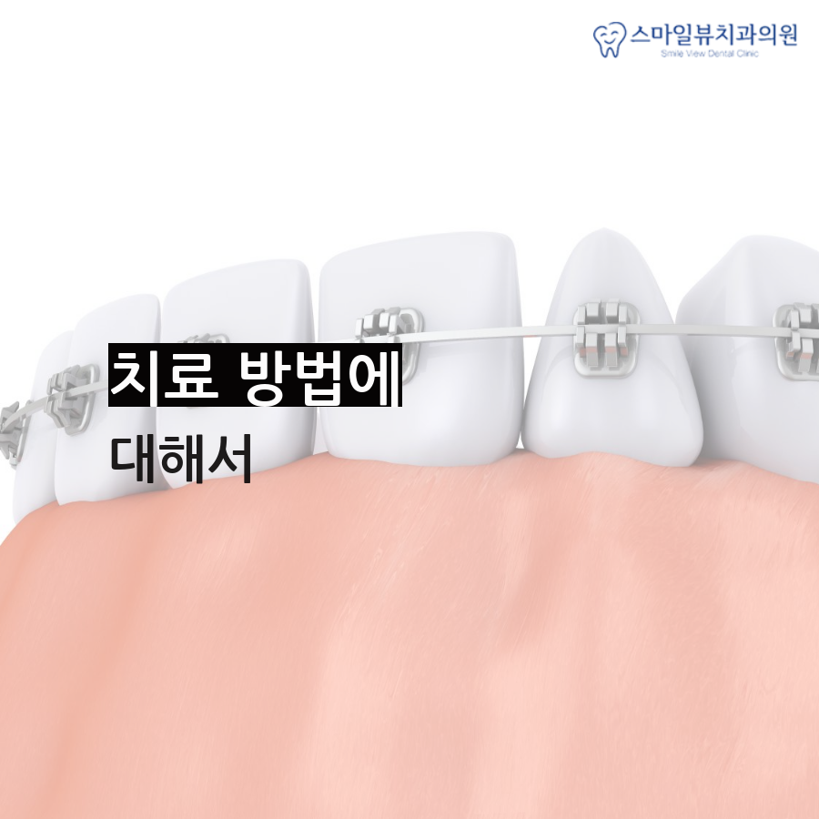 신논현역치과잘하는곳 나에게 맞는 치료법은? 관련 이미지 3
