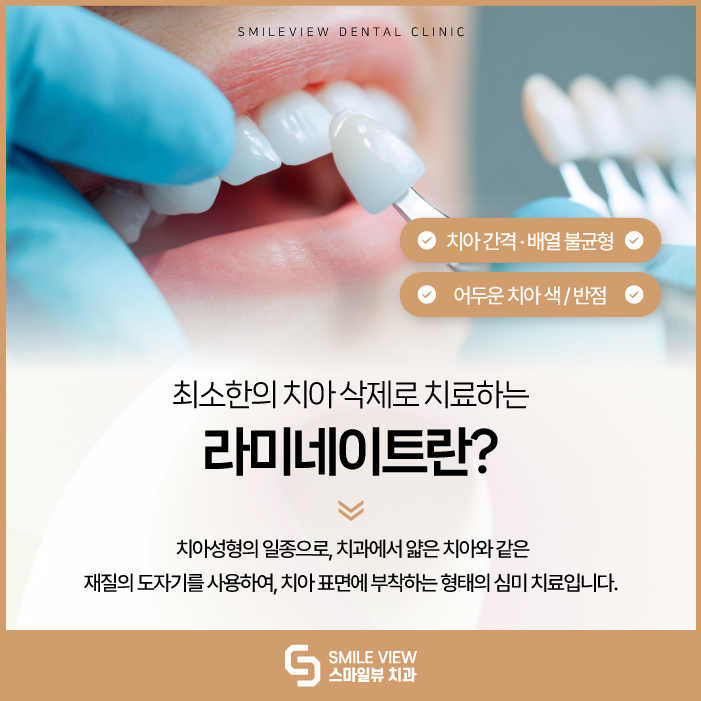 Can Seoul laminate veneers be done for seniors in their 60s and older? image 3