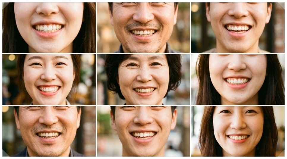 삼성동 치과 쁘띠 치아 성형 심미치과 추천? 시술 전 꼭 확인해야 할 3가지 관련 이미지 8