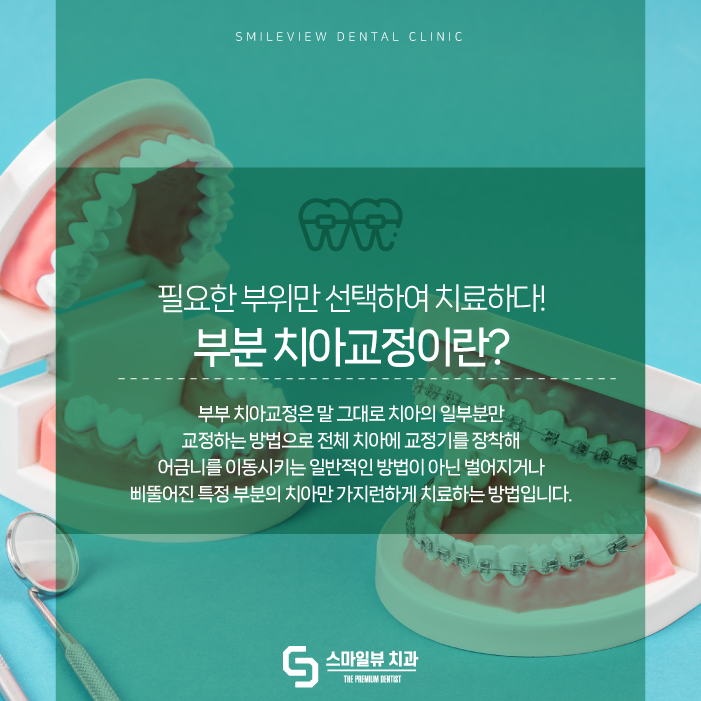 서울교정치과추천 필요한 부분만 선택하여 관련 이미지 2