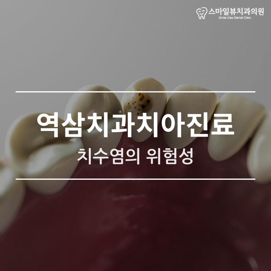 역삼치과치아진료 치수염의 위험성 관련 이미지 1