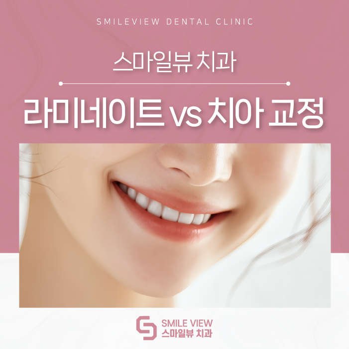 Which Is Right for Me: Nonhyeon-dong Teeth Straightening or Laminates? image 1