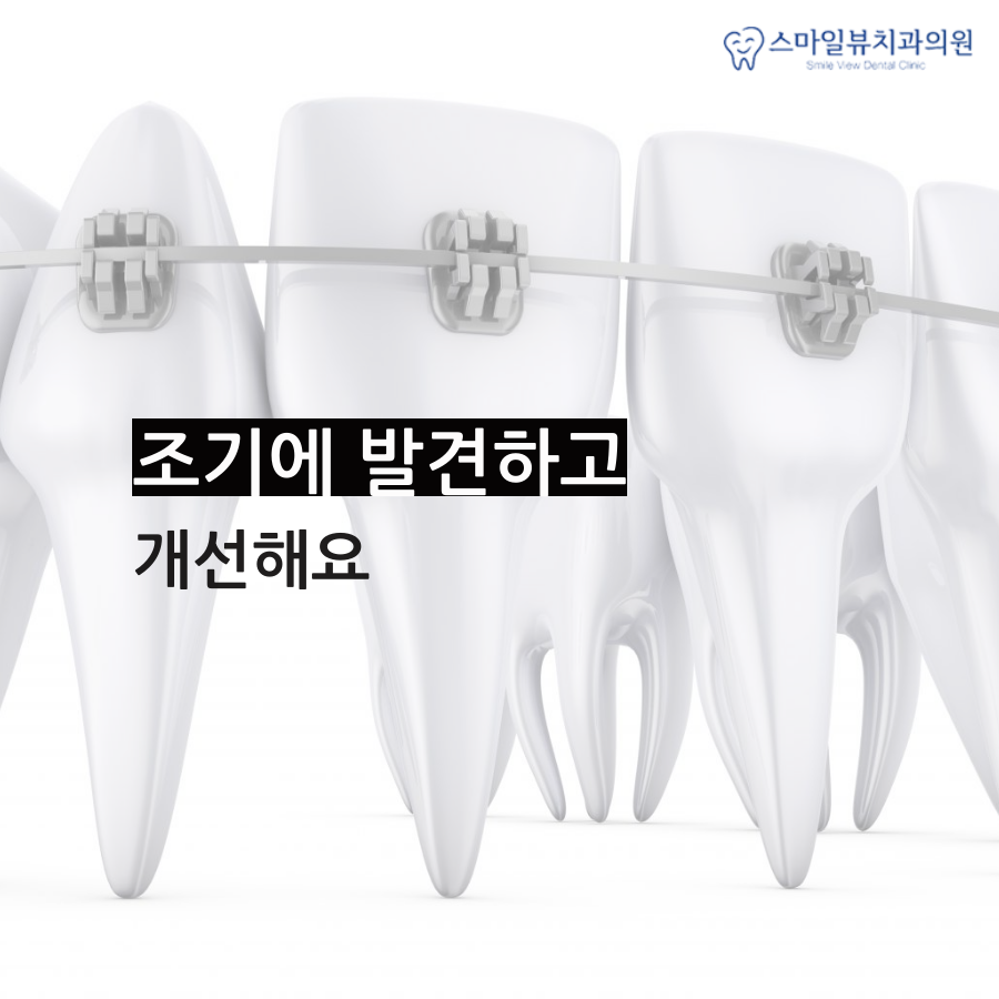 강남치아보존치료 충치를 예방해요 관련 이미지 4