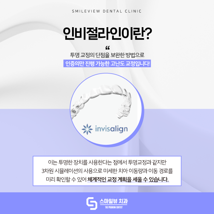 신논현역치과 인비절라인으로 투명하게 교정하고 싶다면 관련 이미지 2