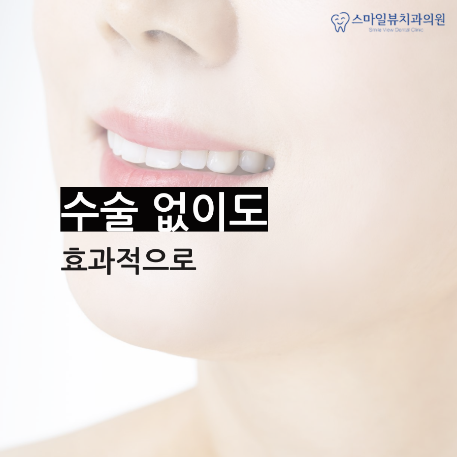 강남돌출입교정 수술 없이 가능해요! 관련 이미지 4