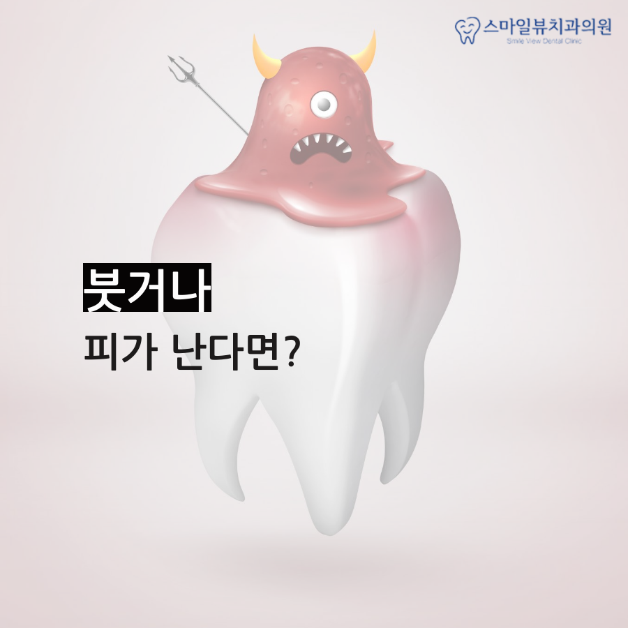 역삼동잇몸치료 예방 방법은? 관련 이미지 2