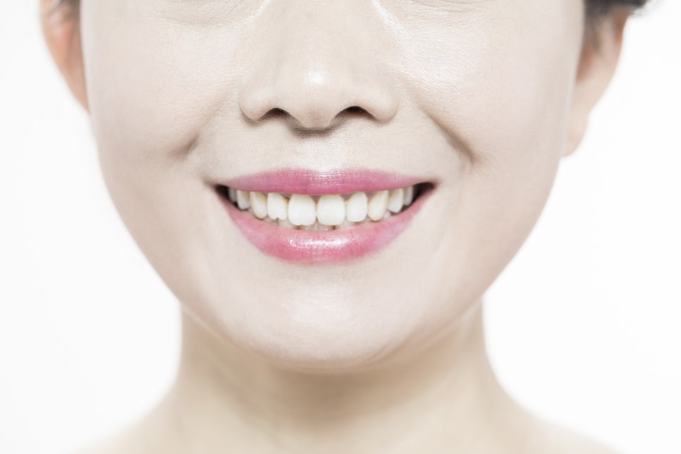 What Is the Most Effective Treatment Method for Gangnam Teeth Whitening for Prospective Brides and Grooms? image 2