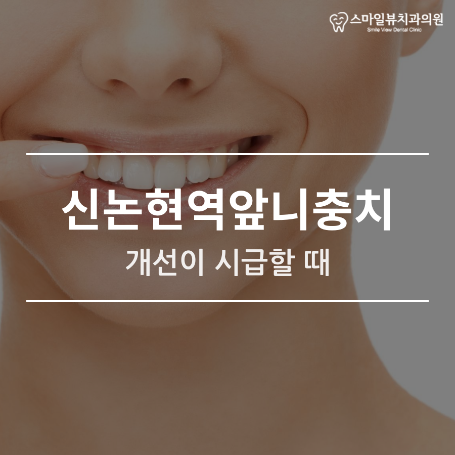 신논현역앞니충치 개선이 시급할 때 관련 이미지 1