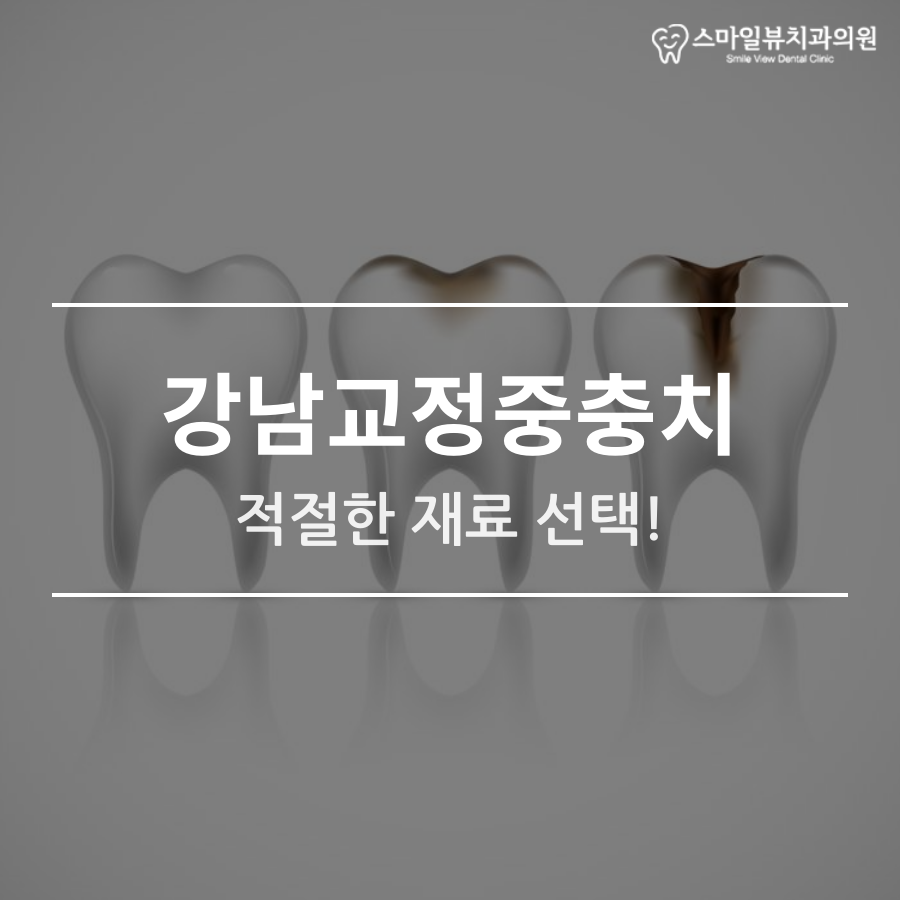 강남교정중충치 적절한 재료 선택! 관련 이미지 1