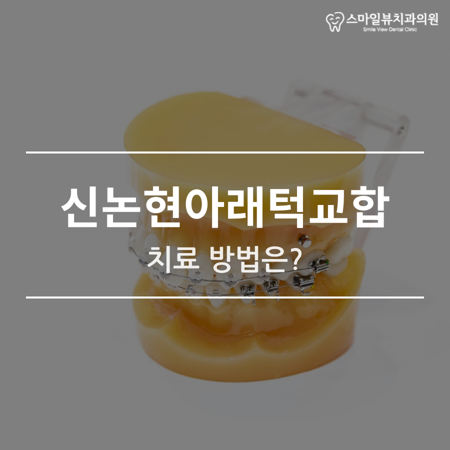 신논현아래턱교합 치료 방법은? 관련 이미지 1