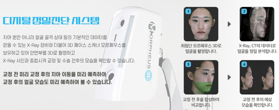 신논현역 치과 비수술 양악교정 관련 이미지 4