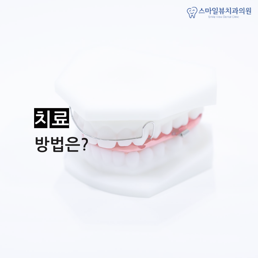 강남치과설측교정 만족스러운 결과 관련 이미지 4