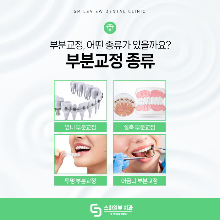 서초동치과 여기만 딱! 부분교정하고 싶어요. 관련 이미지 6