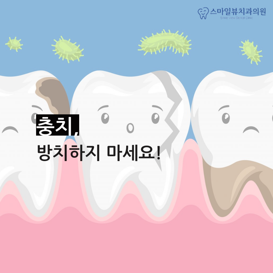 강남치아보존치료 충치를 예방해요 관련 이미지 3
