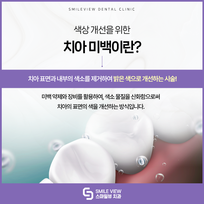 Seoul Teeth Whitening: Why does a bright impression get overshadowed, and why do teeth gradually turn yellow? image 3