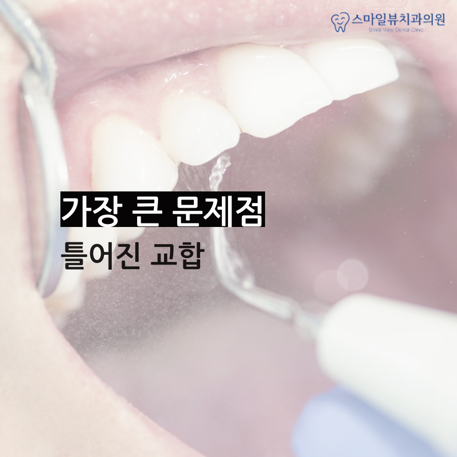 신논현역안면비대칭 빠르게 치료해요 관련 이미지 3