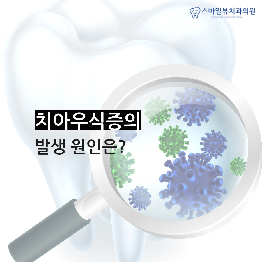 신논현역앞니충치 개선이 시급할 때 관련 이미지 2