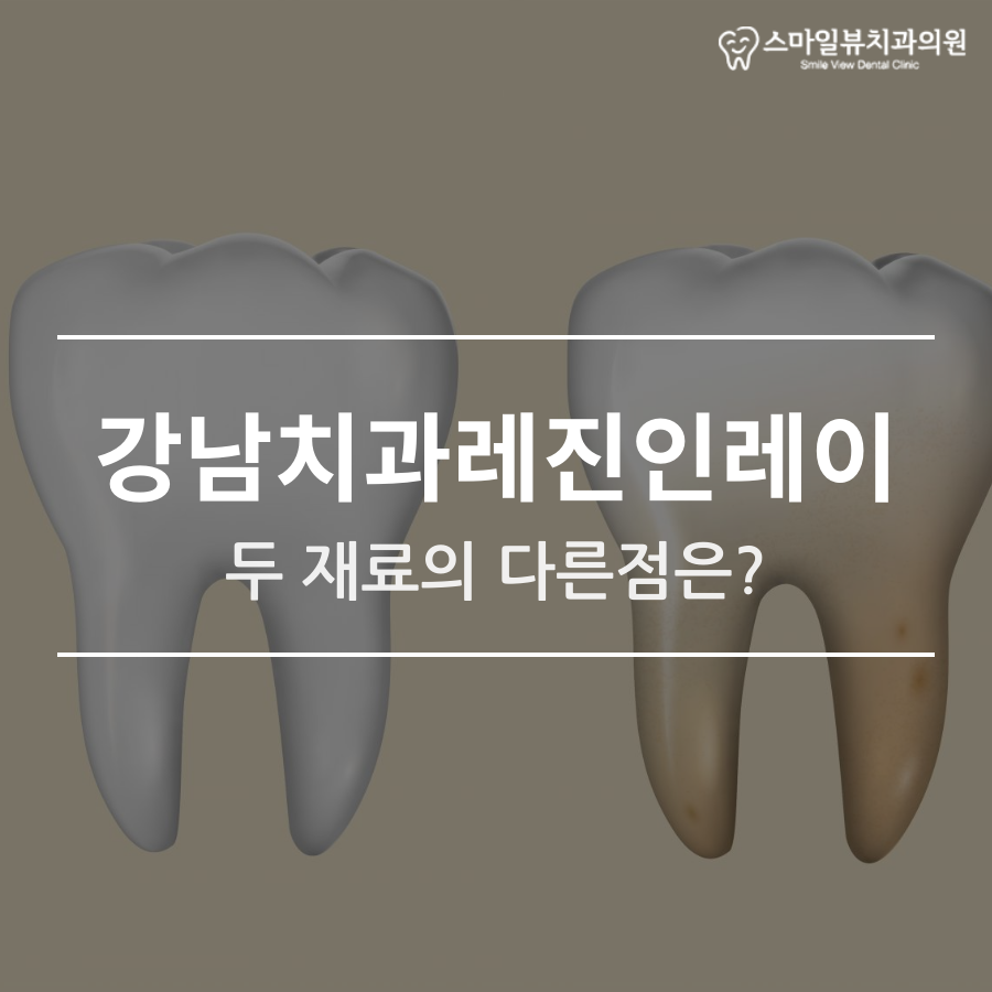 강남치과레진인레이 두 재료의 다른 점은? 관련 이미지 1