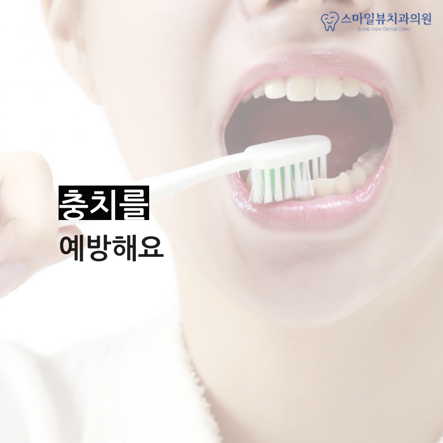 역삼역치과추천 치아우식증 진행과정 관련 이미지 4