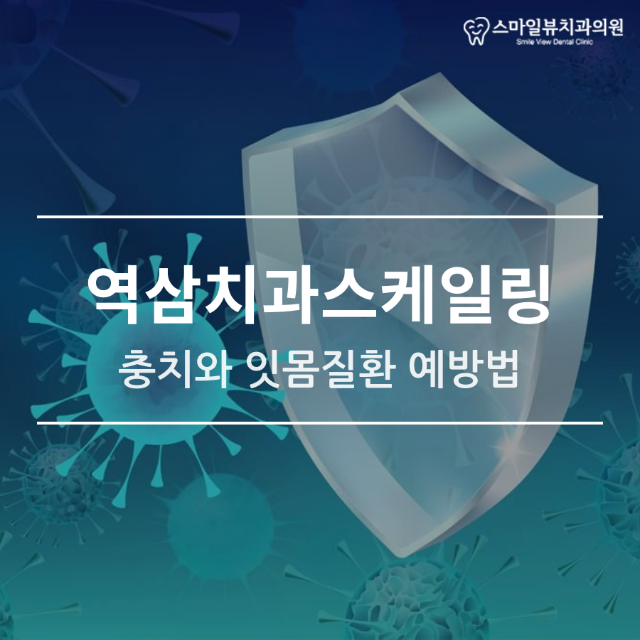 역삼치과스케일링 충치와 잇몸질환 예방법 관련 이미지 1