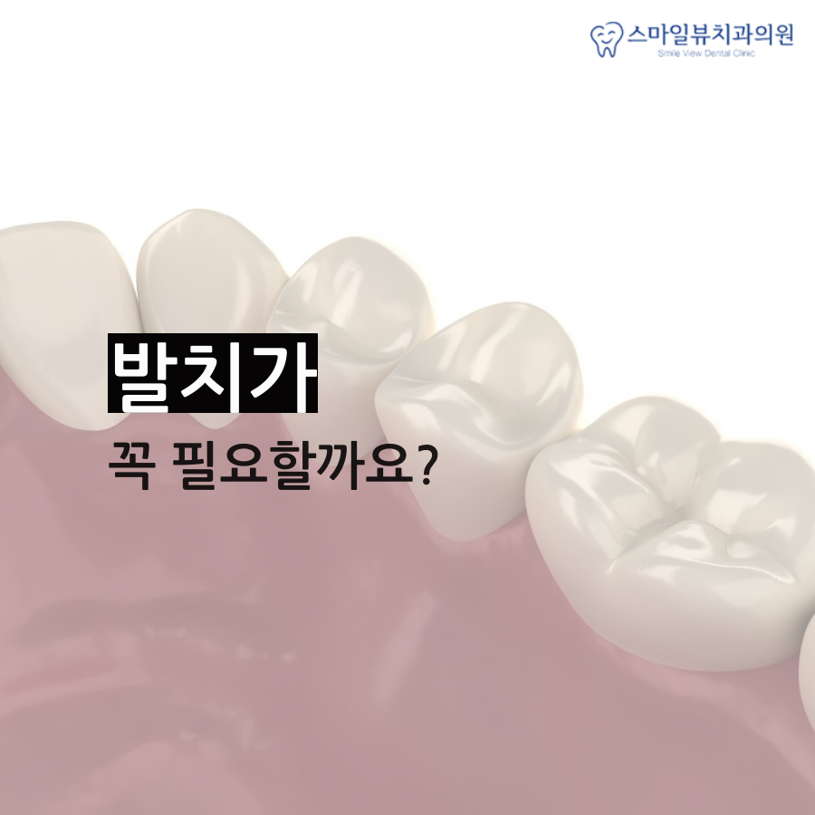 역삼동치아교정치과 시기에 맞춰 진행해요 관련 이미지 4