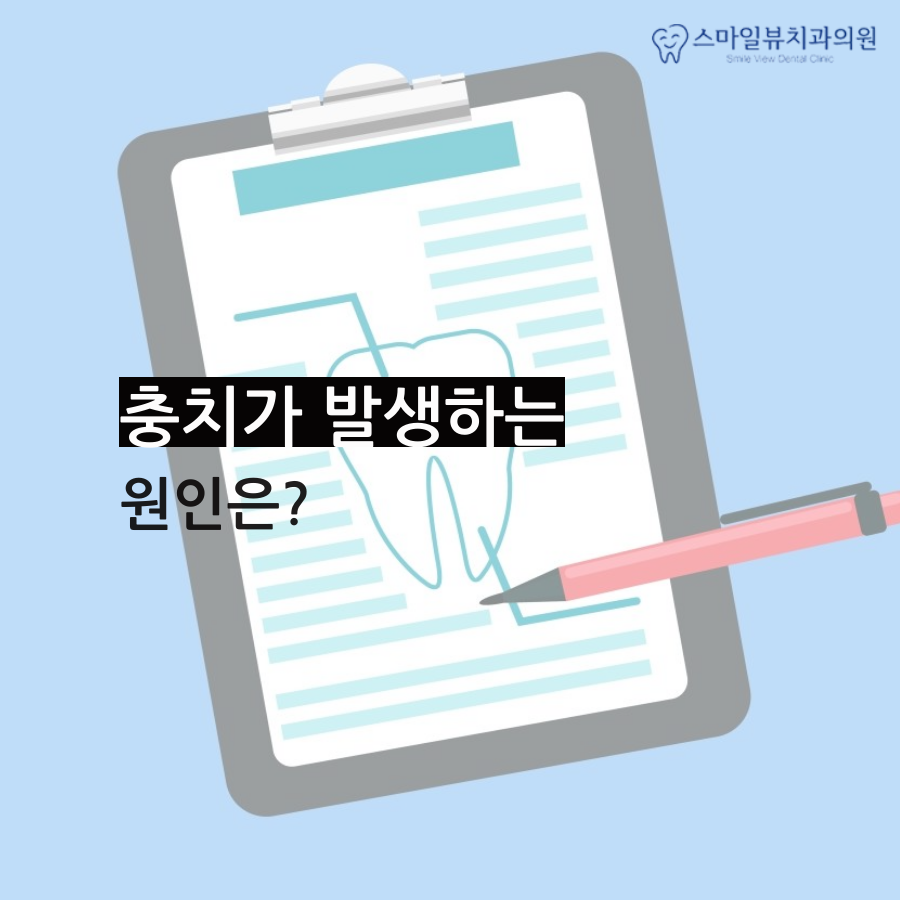 역삼역치과추천 치아우식증 진행과정 관련 이미지 2