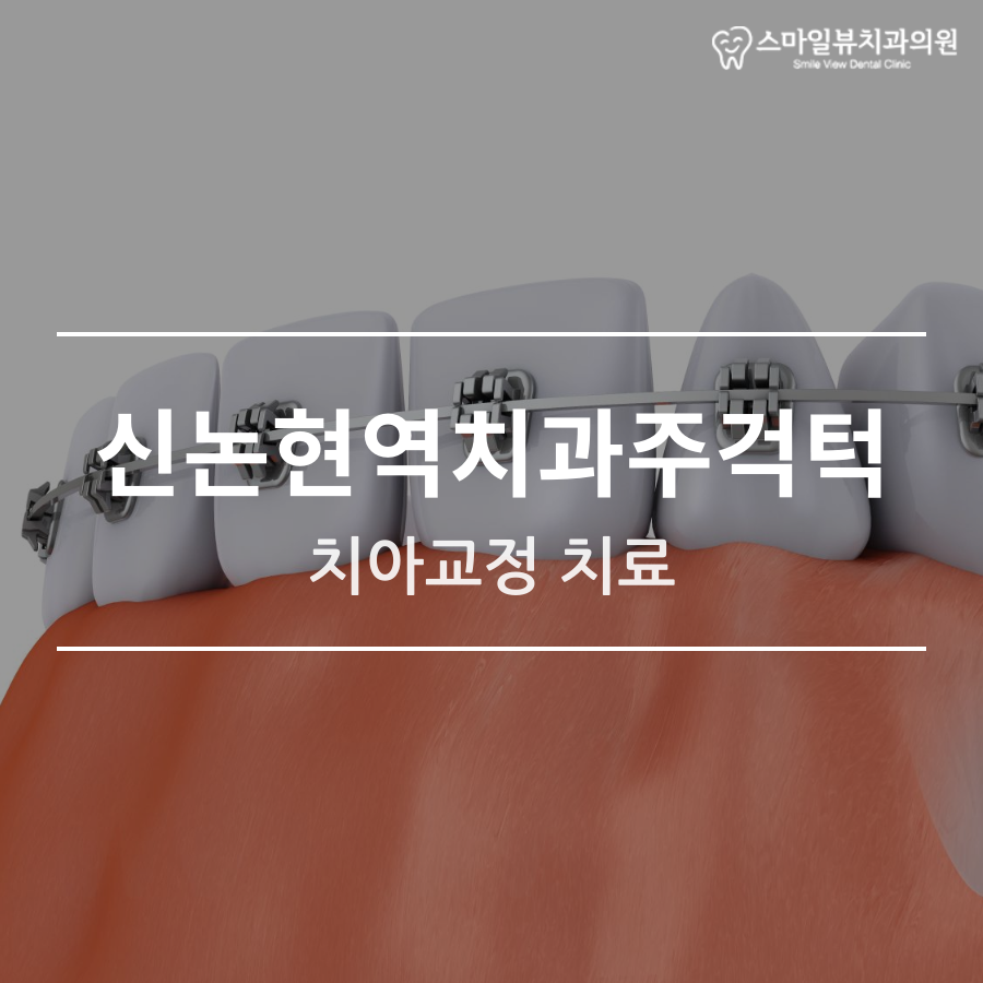 신논현역치과주걱턱 치아교정 치료 관련 이미지 1
