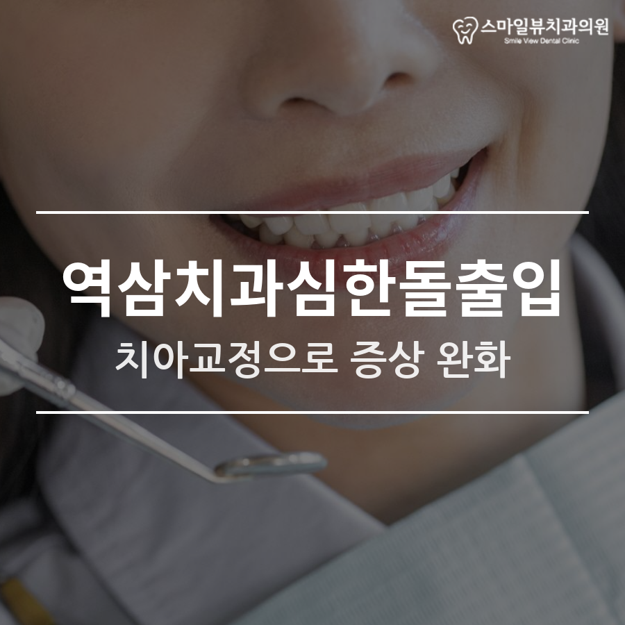 역삼치과심한돌출입 치아교정으로 증상 완화 관련 이미지 1