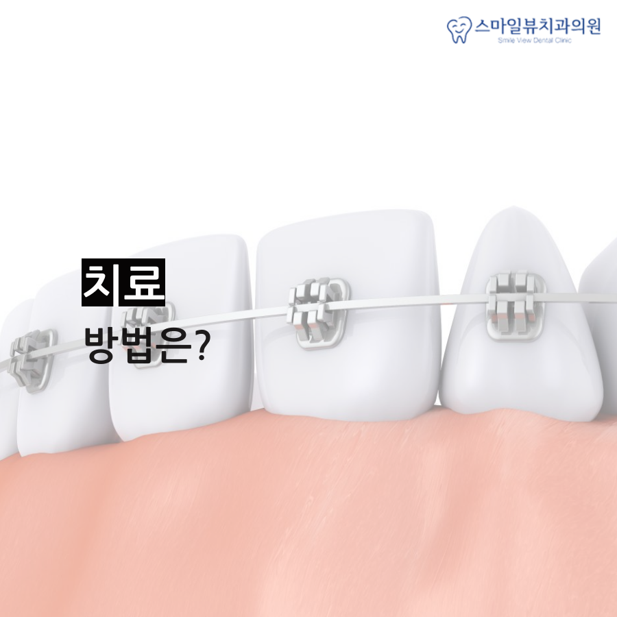 신논현역안면비대칭 빠르게 치료해요 관련 이미지 4