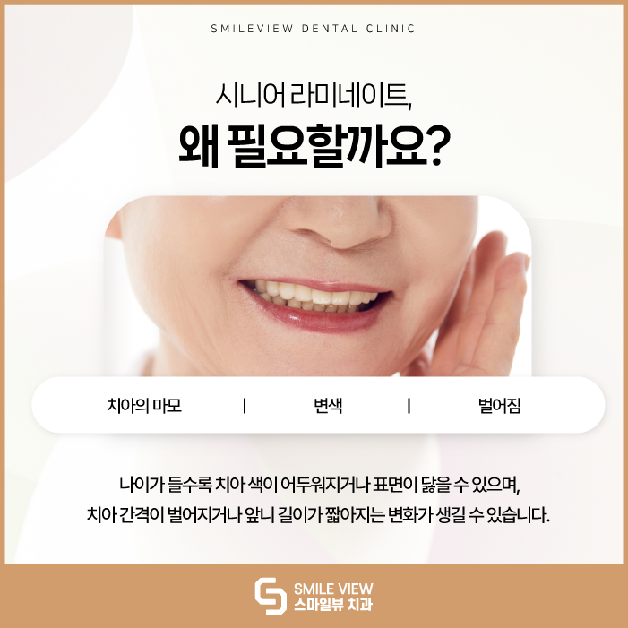 Can Seoul laminate veneers be done for seniors in their 60s and older? image 2