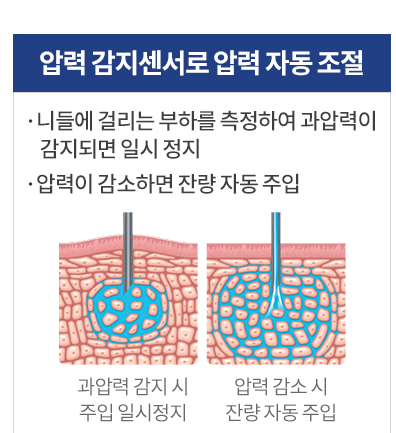 통증없이 치과 치료하는 신논현역 치과 관련 이미지 5