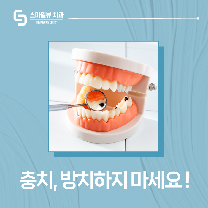 반포동치과 충치 방치하면 후회합니다. 관련 이미지 1