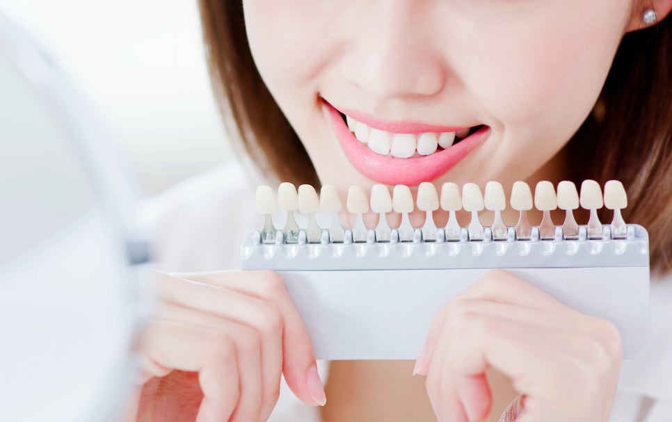 Aesthetic Dentistry, image 2