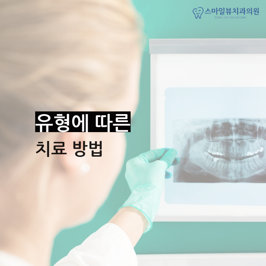 강남역돌출입수술 결정하기 전 주의사항 관련 이미지 2