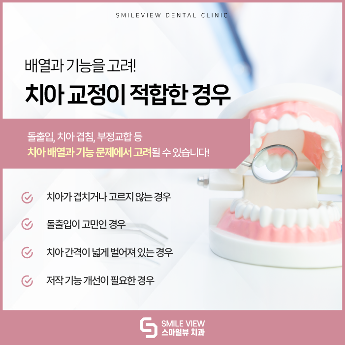 Which Is Right for Me: Nonhyeon-dong Teeth Straightening or Laminates? image 4