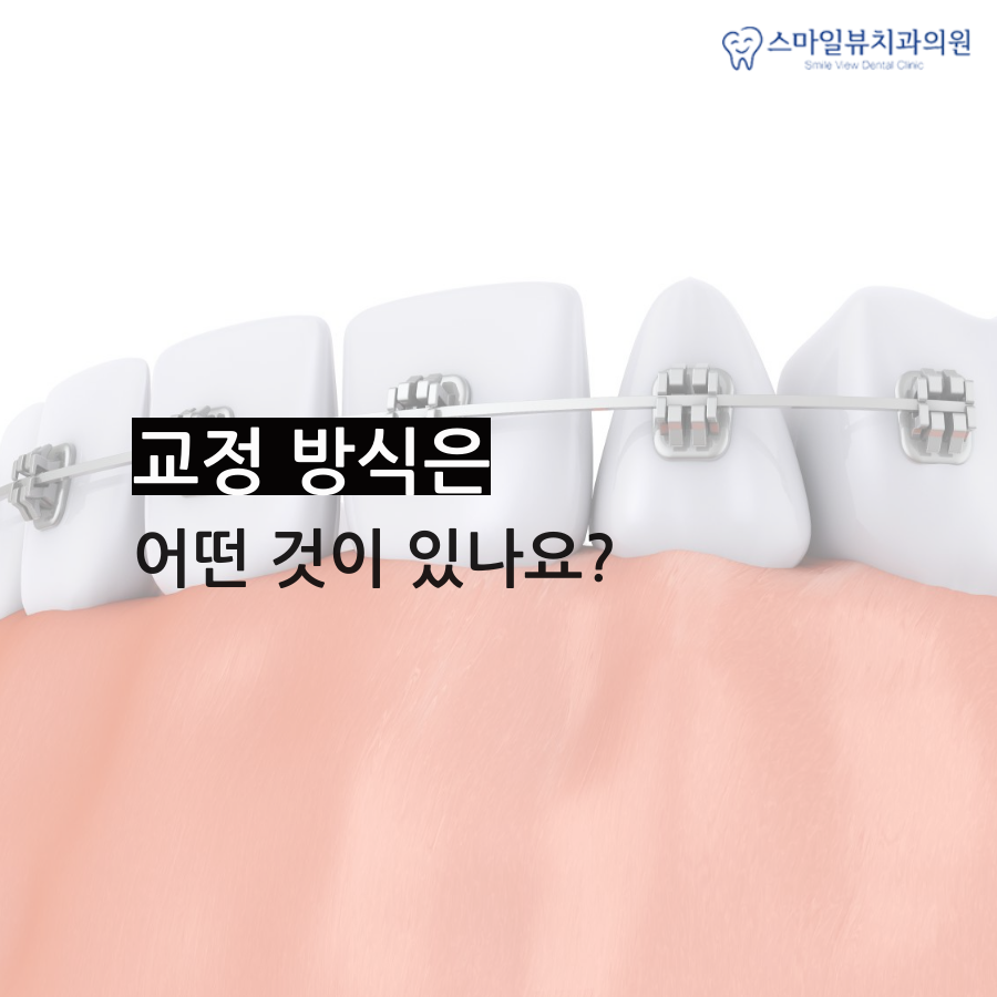 강남치아교정병원 성인도 가능할까? 관련 이미지 3