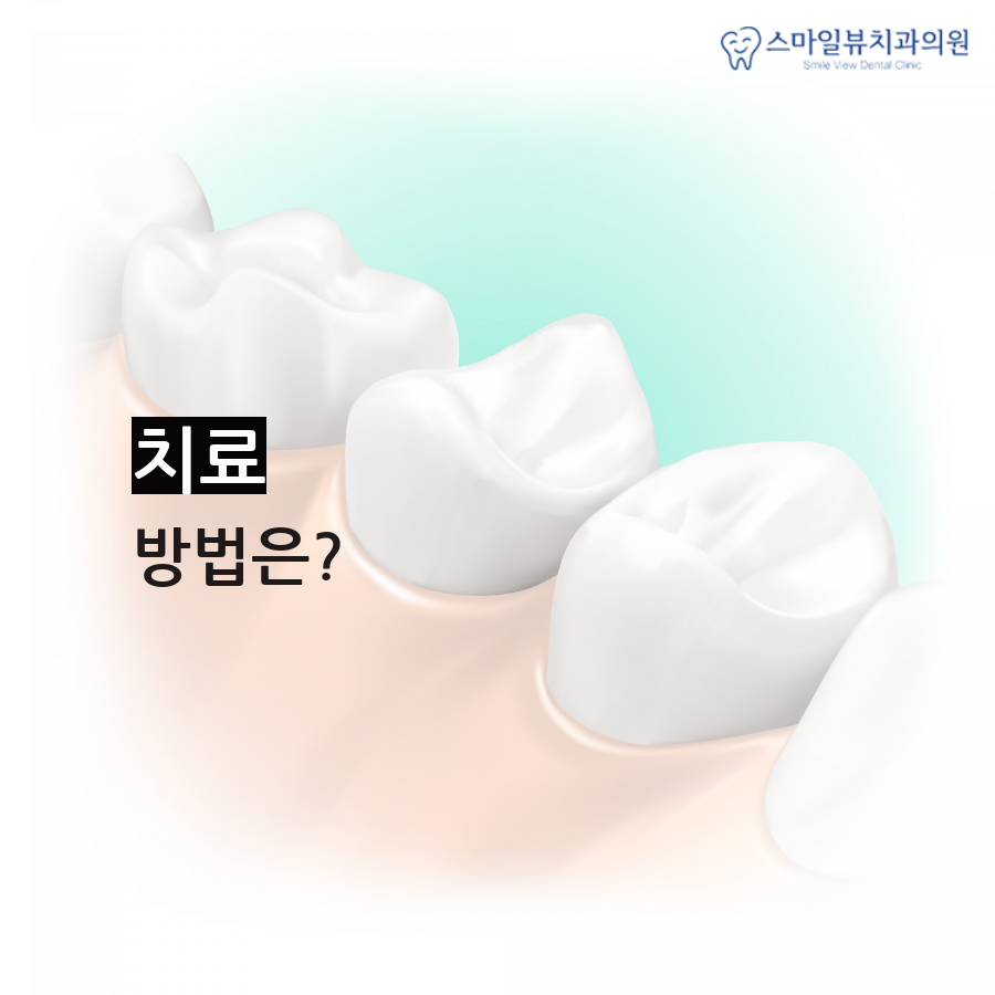 역삼치과심한돌출입 치아교정으로 증상 완화 관련 이미지 3