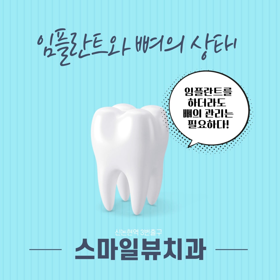임플란트와 뼈의 상태 관련 이미지 1