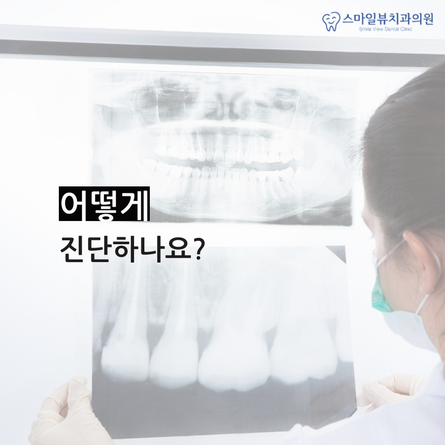 역삼역돌출입교정 치료 계획이 중요 관련 이미지 2
