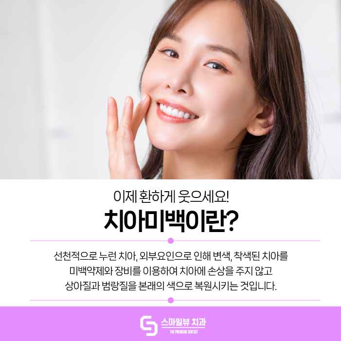 강남치아미백 누런 치아 개선해 보세요. 관련 이미지 3