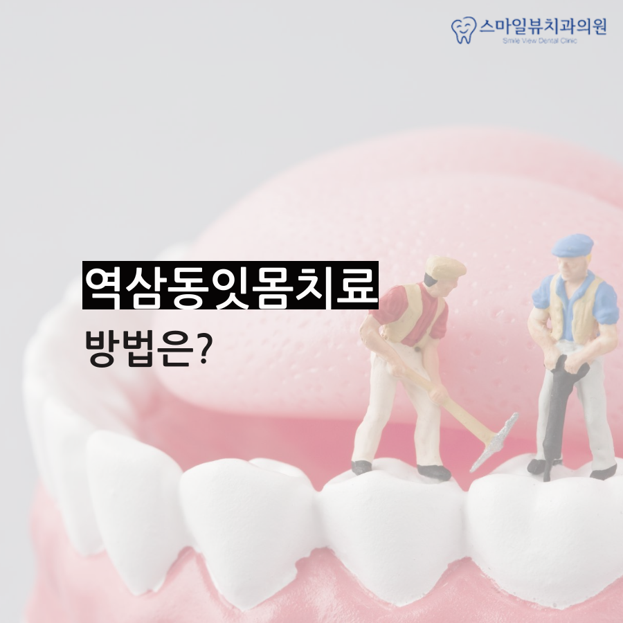 역삼동잇몸치료 예방 방법은? 관련 이미지 3