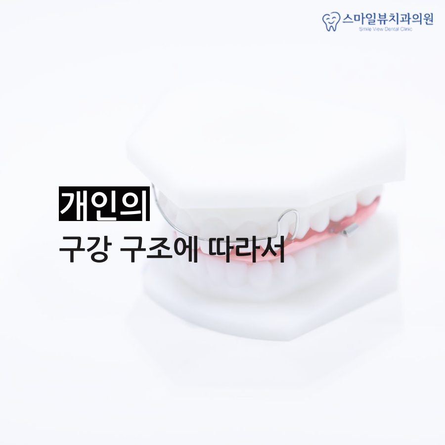 강남역치과부정교합 맞물리지 않는 치아 관련 이미지 2